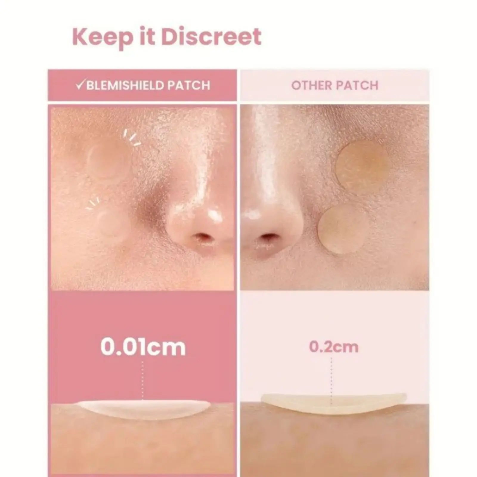 40 pieces of multi-color star acne patches, facial acne patches, concealer acne patches, and pimples patches, ultra-thin.